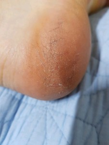 Loción de Manos Más Vendida ROOICELL, Emulsión para el Cuidado de Manos y Pies, 500 ml, Crema Corporal para el Cuidado de la Piel Seca - Product Image 3