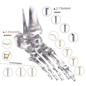 Placa de travamento ortopédica para mãos e pés, fraca de osso de titânio