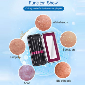 LA ELAHI Kit d'outils de soins de la peau Source de lumière Dissolvant de points noirs et de points blancs Nettoyant pour pores et extracteur de comédons pour le visage et les mains - Product Image 4