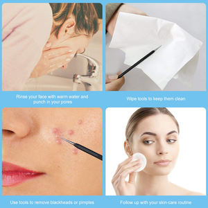 Kit d'outils pour enlever les points noirs, 10 pièces, pinces à épiler, pour homme et femme, en acier inoxydable, à la mode - Product Image 6