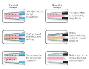 Pinzas bipolares europeas rectas en ángulo, emulación - Product Image 3