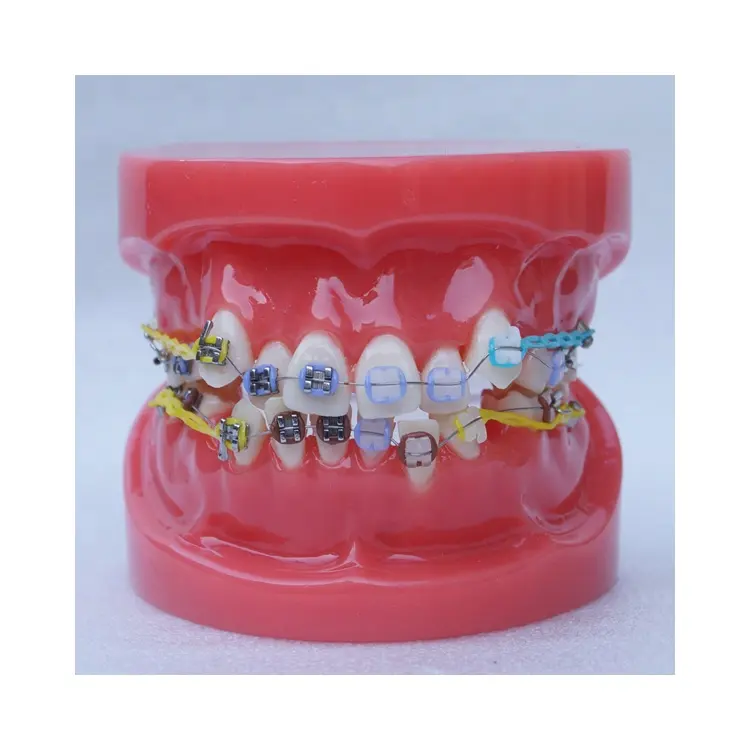 Modelo de dientes de ortodoncia Dental