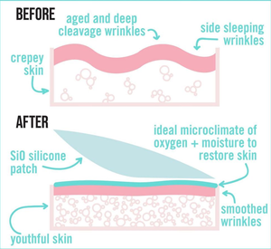 Patchs Esthétiques Bio Véganes en Silicone Réutilisables Anti-Rides pour les Yeux et le Corps, Sans BPA ni Latex, 100% Qualité Médicale - Product Image 3