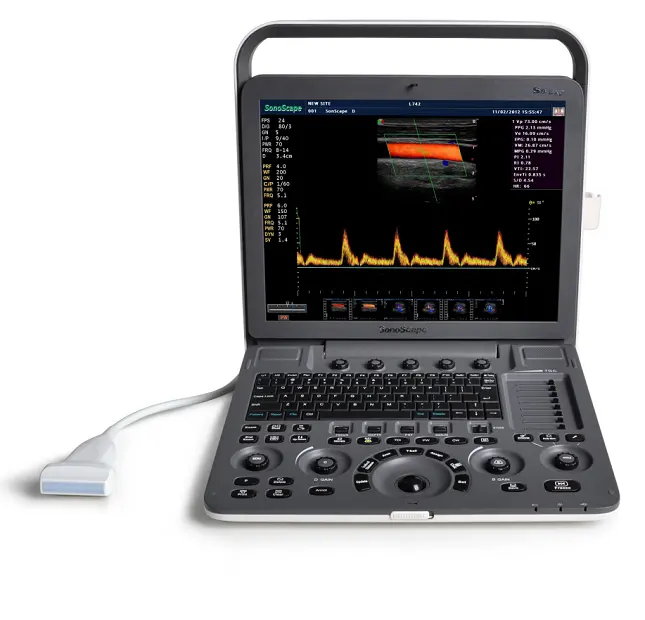 Sonoscape S8 EXP超音波ソール販売価格