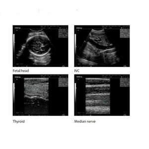 DP-2200 Ultraschall-Diagnose-Bildgebung scanner Ultraschall-Maschine OB-Messung - Product Image 4
