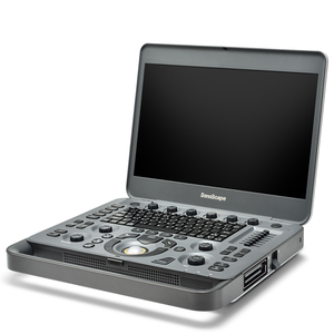 Ecógrafo Doppler Color Portátil Sonoscape X3 a <span class=keywords><strong>Precio</strong></span> de Fábrica - Product Image 1