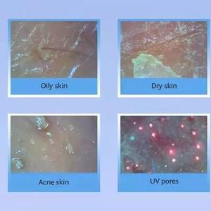 เครื่องวิเคราะห์หนังศีรษะไร้สาย,เครื่องวิเคราะห์หนังศีรษะเครื่องวิเคราะห์วิเคราะห์หนังศีรษะวิเคราะห์ผิวและเส้นผมด้วยกล้องจุลทรรศน์ Wifi ดิจิตอล - Product Image 3