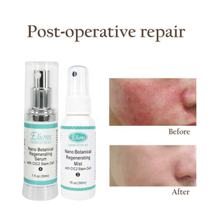 Tratamiento Revitalizante para la Piel SPA de 5 Días, Corrector de Acné y Pigmentación Antiedad, Kit Facial Jessner Peel - Product Image 4