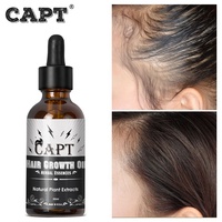 Sérum de croissance capillaire pour cheveux noirs, meilleur produit indien à base d'herbes pour homme et femme, pour tête chauve