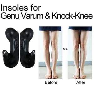 Solette per scarpe funzionali per la correzione di Genu Varum, Knock-Knee, x-bein leg (Made in South Korea)