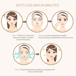 Kit professionnel 6-en-1 de pinces à points noirs incurvées 2026 – Extracteur de comédons pour le traitement de l'acné du visage, couleur noire - Product Image 5