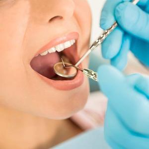 Juego de 5 Kits de Higiene Dental al por Mayor, de Acero Inoxidable Plateado, Reutilizables, para Limpieza Dental y Relleno de Dientes - Product Image 6