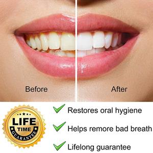 Herramientas Profesionales de Limpieza Dental ODM OEM 2026, 5 Piezas, Palillos Dentales de Acero Inoxidable, Certificación CE Clase I, Reutilizables para Uso Manual - Product Image 3
