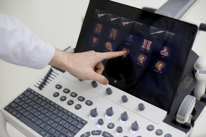 Sonoscape S50 P50 Machine à ultrasons diagnostique chariot 3D/4D pour instruments à ultrasons médicaux
