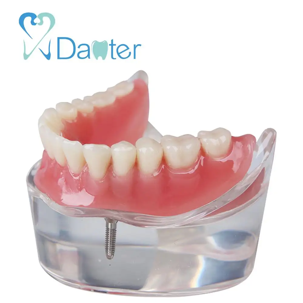Danter 2 implantes restauración sillones modelo dental, implante dental herramienta para la formación