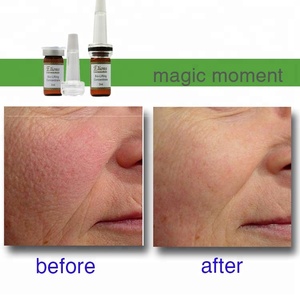 أمبولة مصل الرفع الحيوي مع أسيتيل هيكساببتيد-3 و 10% مستخلص من الأعشاب البحرية تركيبة تقوية مكافحة الشيخوخة مغذية بالبكبتيدات - Product Image 3