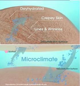 Almohadillas reutilizables para rejuvenecimiento de la piel, de silicona, para cara, Alemania - Product Image 6