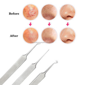 Clip curvo Pimple Blemish Comedone Extractor Remover Tool Blackhead Acné Eyebrow Trimmer Diseño de curva conveniente - Product Image 2