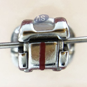 Ортодонтические стельки для зубов, 2G - Product Image 2