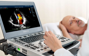 ممتازة الأداء Mindry لاب توب محمول آلة الموجات فوق الصوتية دوبلر M9 ماسح ضوئي بالموجات فوق الصوتية - Product Image 6