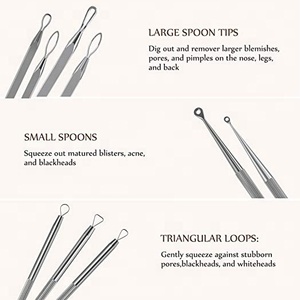 Removedor de espinillas/juego de removedor de espinillas cara nariz acné manchas removedor de espinillas conjunto de herramientas de la mejor calidad por Life Care Instruments - Product Image 4