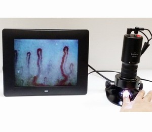 Taiwan 320X Digilens DMX 980-1 Microscope à ongles Microscope à doigts biologique - Product Image 5