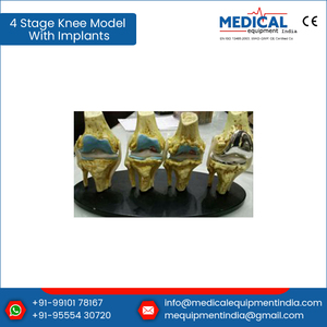 Alta calidad, modelo de rodilla de 4 etapas con implantes - Product Image 2
