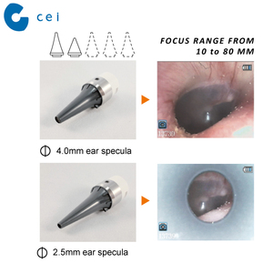 Caméra vidéo portable pour animaux Otoscope Haute résolution Instrument vétérinaire - Product Image 2