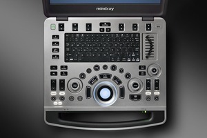 ممتازة الأداء Mindry لاب توب محمول آلة الموجات فوق الصوتية دوبلر M9 ماسح ضوئي بالموجات فوق الصوتية - Product Image 3