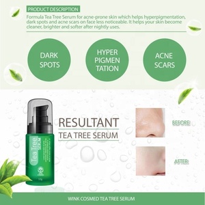 OEM ODM Private Label Skin Care <b>Tea</b> <b>Tree</b> Serum Green <b>Tea</b> Liquid Organic Natural Acne Remover Dark Spot Brightening Smoothing - Product Image 3