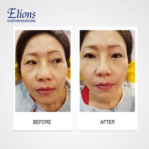 Private Label 2 minute Instant Anti Wrinkle Skin Lifting Serum - Product Image 3