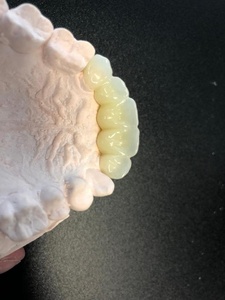 Fornitore di Blocchi di Zirconia Silide per Corone e Ponti Dentali 3D <span class=keywords><strong>Pro</strong></span> A2 - Product Image 5