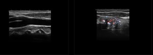 NUEVO Sonoscape P9, Ecógrafo Doppler con Carro, Sonda Volumétrica 4D, Monitor Médico HD <span class=keywords><strong>de</strong></span> 15 Pulgadas, Tecnología <span class=keywords><strong>de</strong></span> Vanguardia - Product Image 3
