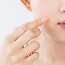 INNISFREE Bija-Parche para el acné, parches para el cuidado de la piel, maquillaje cosmético coreano, 12 Uds. - Product Image 4