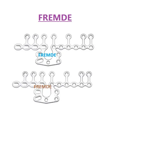 골반 플레이트 정형 플레이트