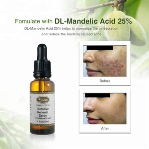 Mandelic 25% กรด Niacinamide สมุนไพรต่อต้านริ้วรอยไวท์เทนนิ่งเจลสำหรับผิวหน้ากระจ่างใสและลอกผิวไม่แพ้ง่าย - Product Image 4