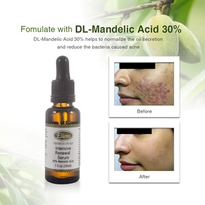 30% Mandelic Acid เซรั่มป้องกันสิวสิวผิวใบหน้าเปลือกชะเอม Aha - Product Image 2