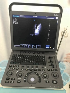 Sonosbape S8 EXP Pemindai <span class=keywords><strong>Ultrasound</strong></span> Portabel, Mesin <span class=keywords><strong>Ultrasound</strong></span> Gema Doppler Warna