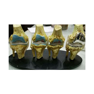 Alta calidad, modelo de rodilla de 4 etapas con implantes - Product Image 1