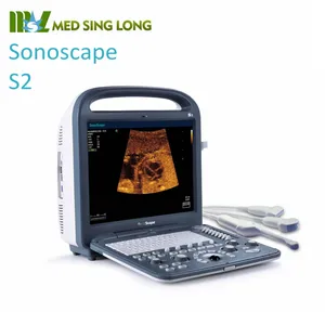 Scanner portátil sonoscabo s2, mais barato, ultrassom msk, preço de fábrica 4d, suporte