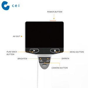Otoscope médical, équipement, écran LCD HD - Product Image 2
