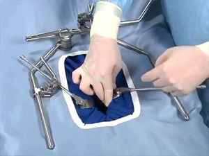 Système de rétracteur Omni Tract / Rétracteur auto-retenant monté sur table - Product Image 6