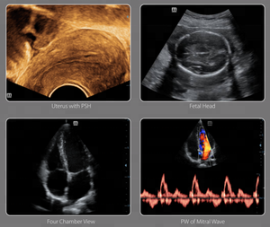 <span class=keywords><strong>Mindray</strong></span> Siêu Âm <span class=keywords><strong>DC</strong></span>-30 Xe Đẩy Loại Màu Doppler Máy Siêu Âm Với CE Và ISO - Product Image 6