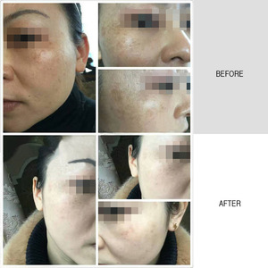 Liquide Exfoliant Réducteur de Pores Marque Blanche Éclaircissant Corporel Anti-Taches Anti-Âge Soin Peau Noire - Product Image 3