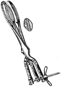 คีมผ่าตัดคลอดแบบแมนนวล Auvard-Zweifel - รากฐานของเครื่องมือผ่าตัด ขนาด 46 ซม. สำหรับใช้ในโรงพยาบาล ยี่ห้อ Mahersi - Product Image 4