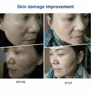 Sérum exfoliant éclaircissant pour la peau à l'acide de canne à sucre, multi-vitamines, peeling blanc, anti-âge, réduit la mélanine, les taches brunes - Product Image 3