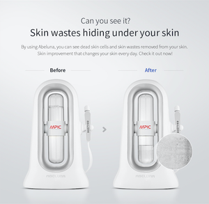 เครื่องดูดสิวเสี้ยน Abeluna ขจัดเซลล์ผิวที่ตายแล้ว นวัตกรรมการดูดสิ่งสกปรกบนผิว (กระจก 360 องศา 1 ชิ้น เครื่องผลัดเซลล์ผิวด้วยน้ำ) - Product Image 5