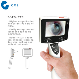 Otoscope médical, équipement, écran LCD HD - Product Image 5
