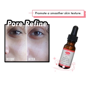 10% a.h.a สารสกัดจากอัลมอนด์แอซิด Oryza sativa เซรั่มบำรุงผิวหน้าปรับสีผิวให้กระจ่างใสช่วยขจัดจุดด่างดำทำให้ผิวขาวขึ้น - Product Image 4