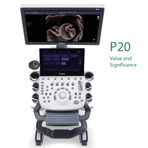 Sonoscape P20 Ultrasound Machine Color Doppler
